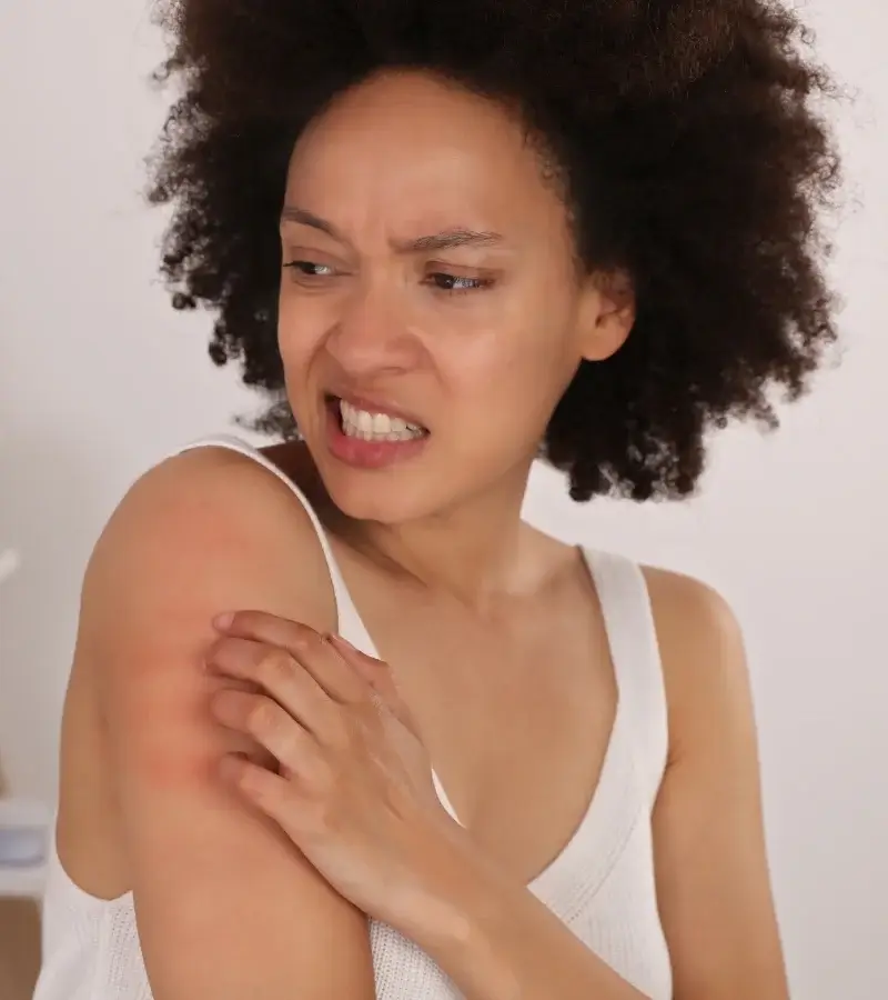 an image of a woman itching her arm